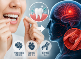 치실 하나가 뇌혈관 건강까지? 잇몸 염증 줄이는 습관에 주목